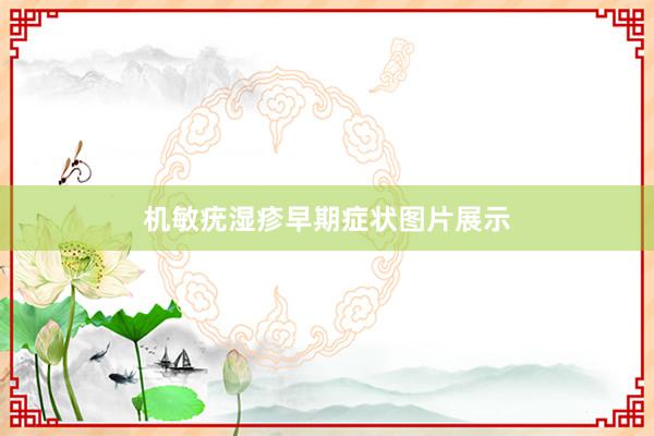 机敏疣湿疹早期症状图片展示